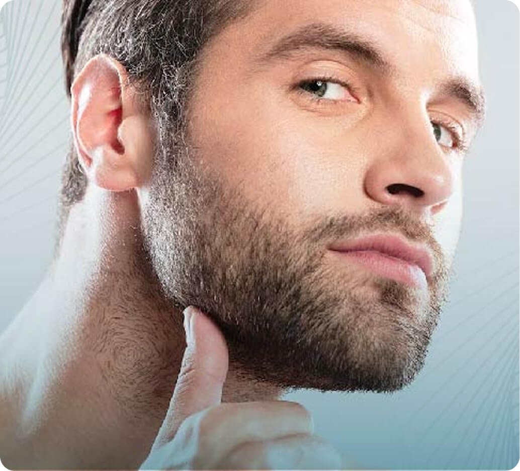 Why beard transplantation in Thailand