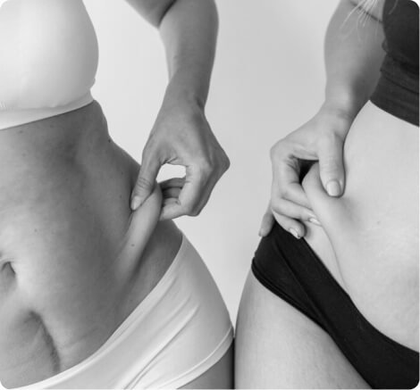 Body lift
