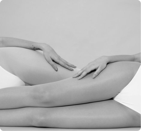 Thigh lift