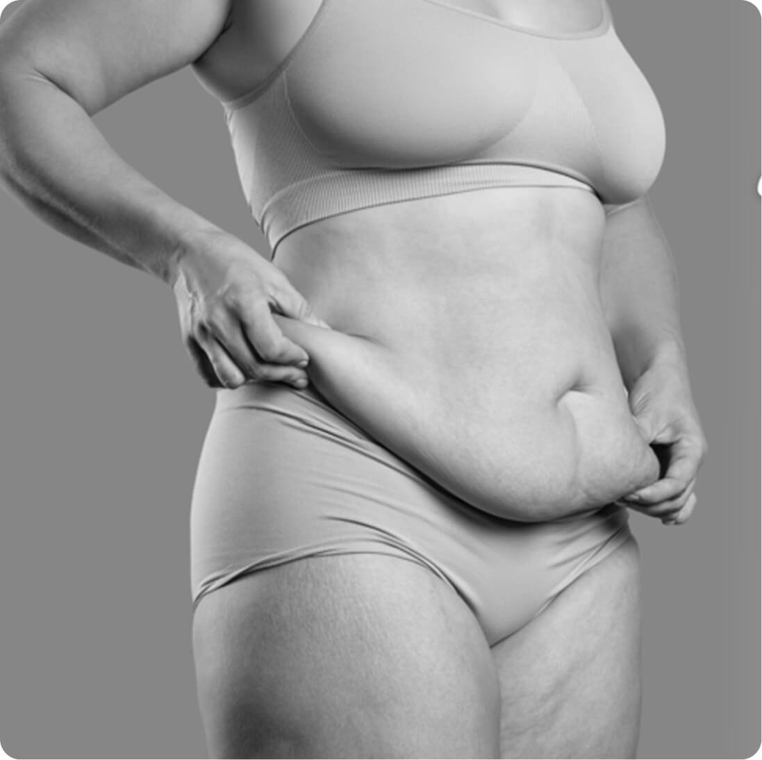 Body lift result