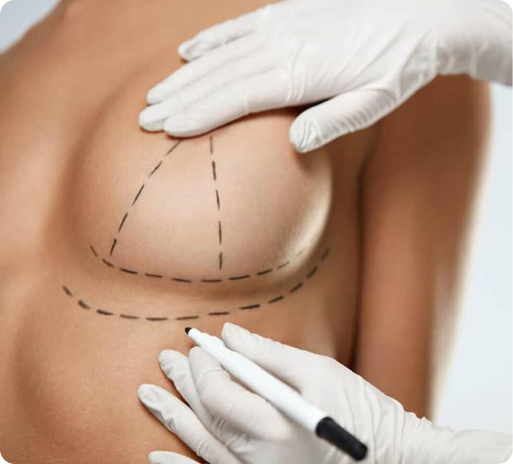 Why breast lift in Thailand