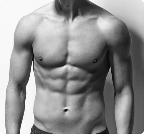 Male breast reduction