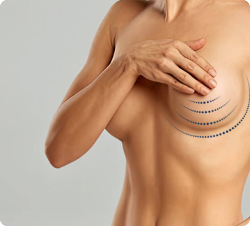 Why breast reduction in Thailand