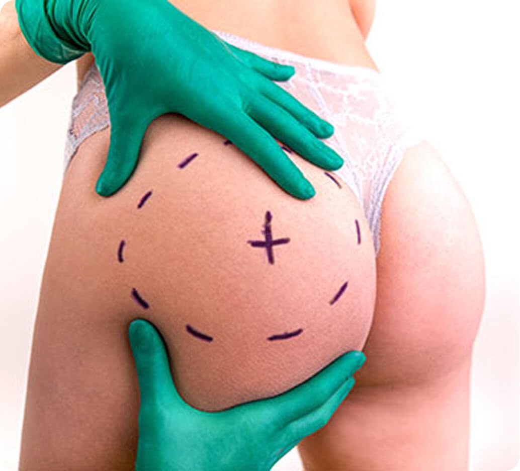 Why buttock augmentation in Thailand