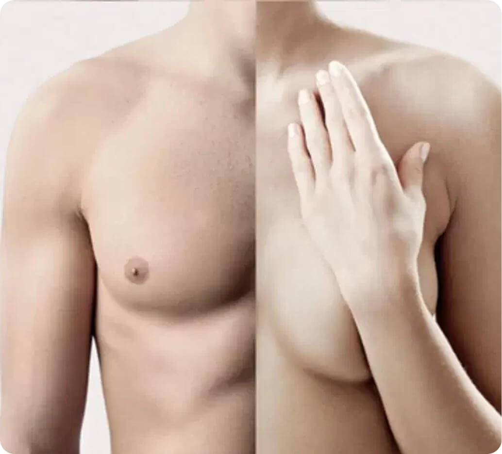 Why chest gender affirmation surgery in Thailand