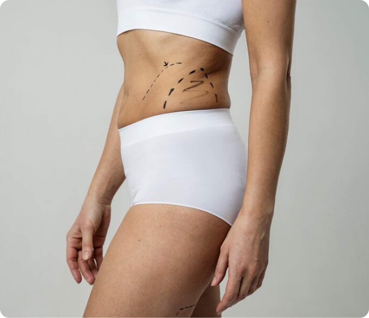 Body contouring