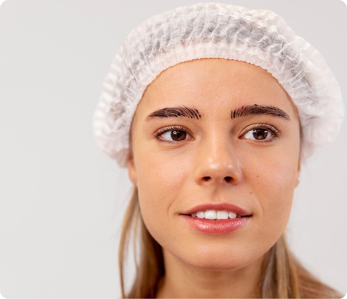 Eyebrow transplantation
