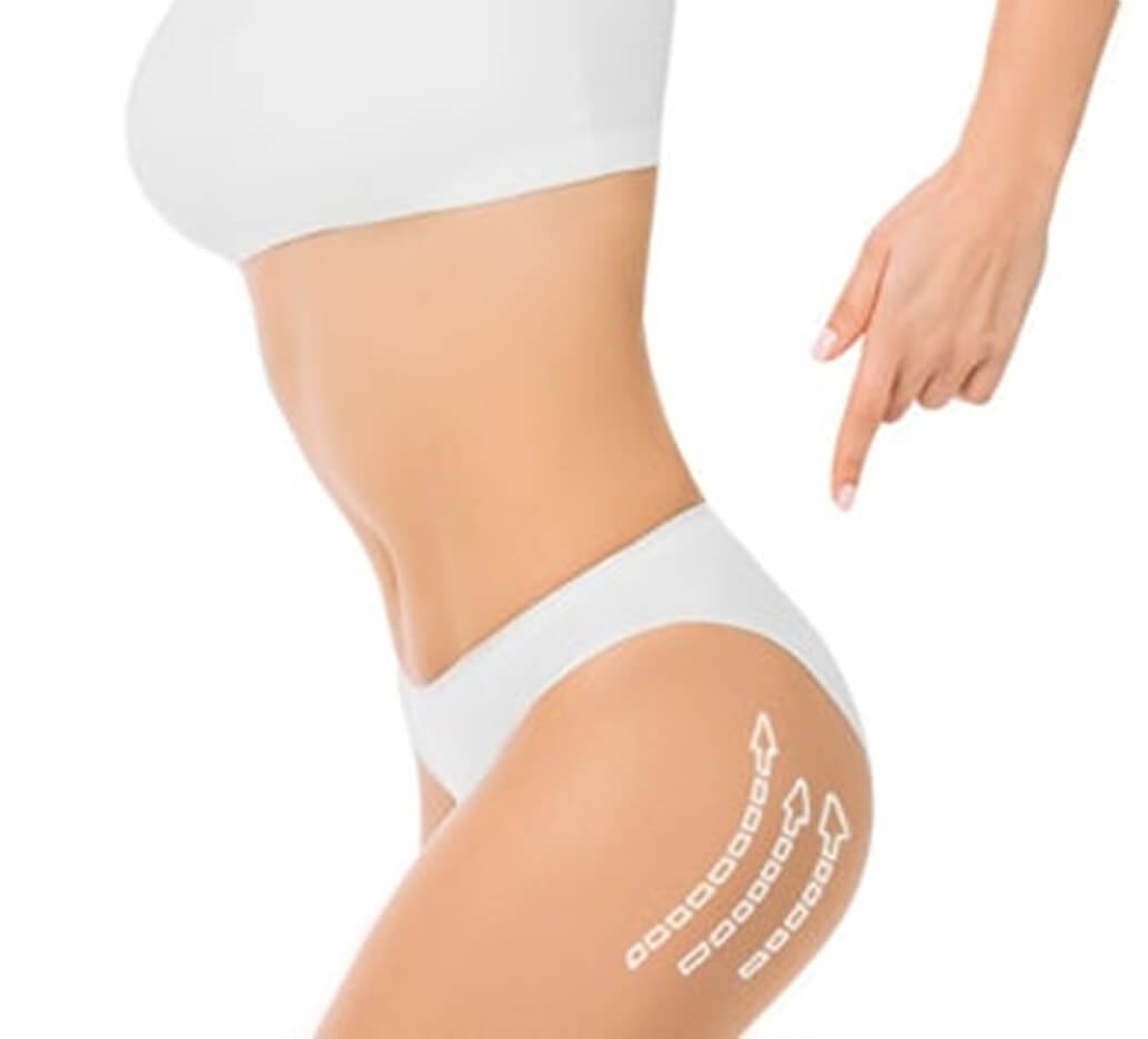 Why hip augmentation or reduction in Thailand