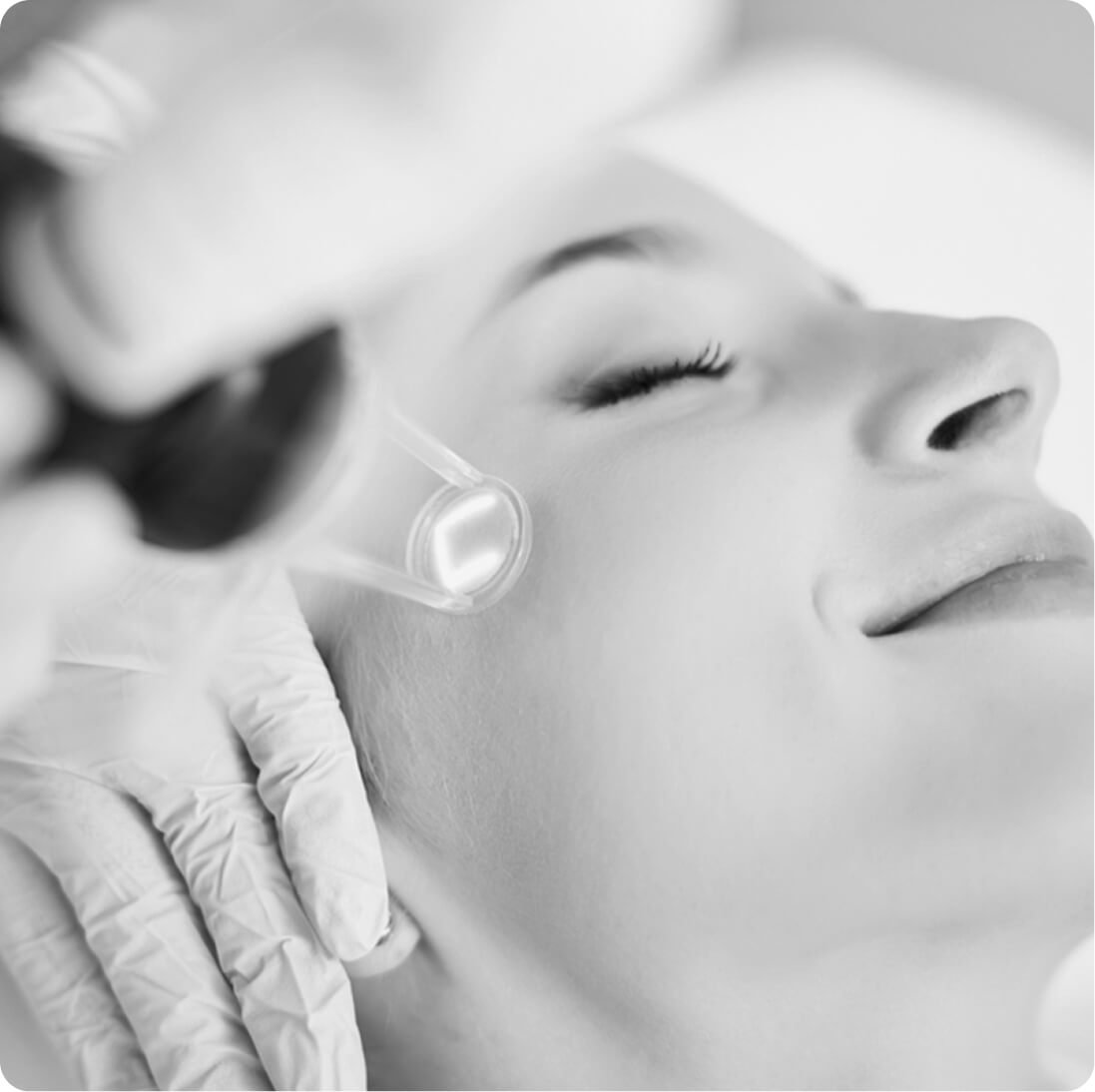 Laser skin resurfacing result