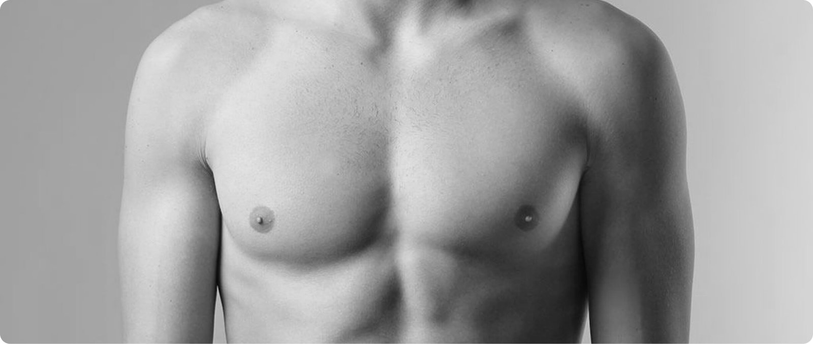 Male breast reduction gynecomastia