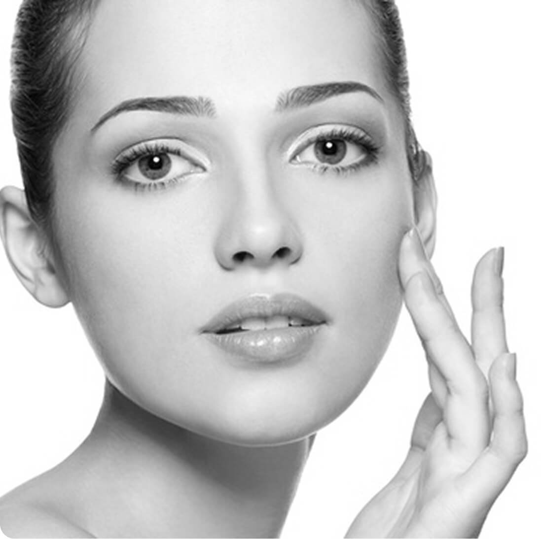 Microdermabrasion result