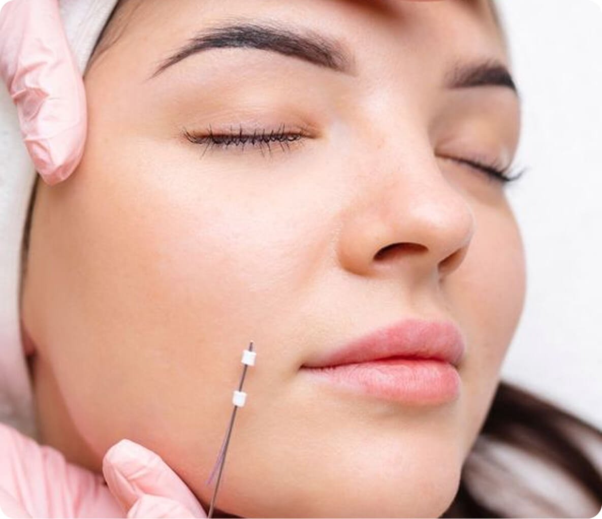 Skin rejuvenation treatments