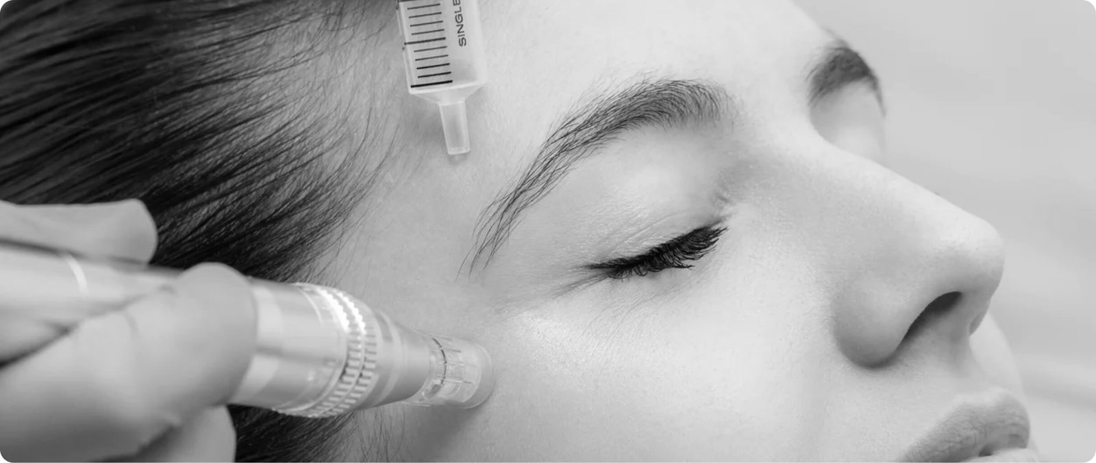 PRP facial rejuvenation