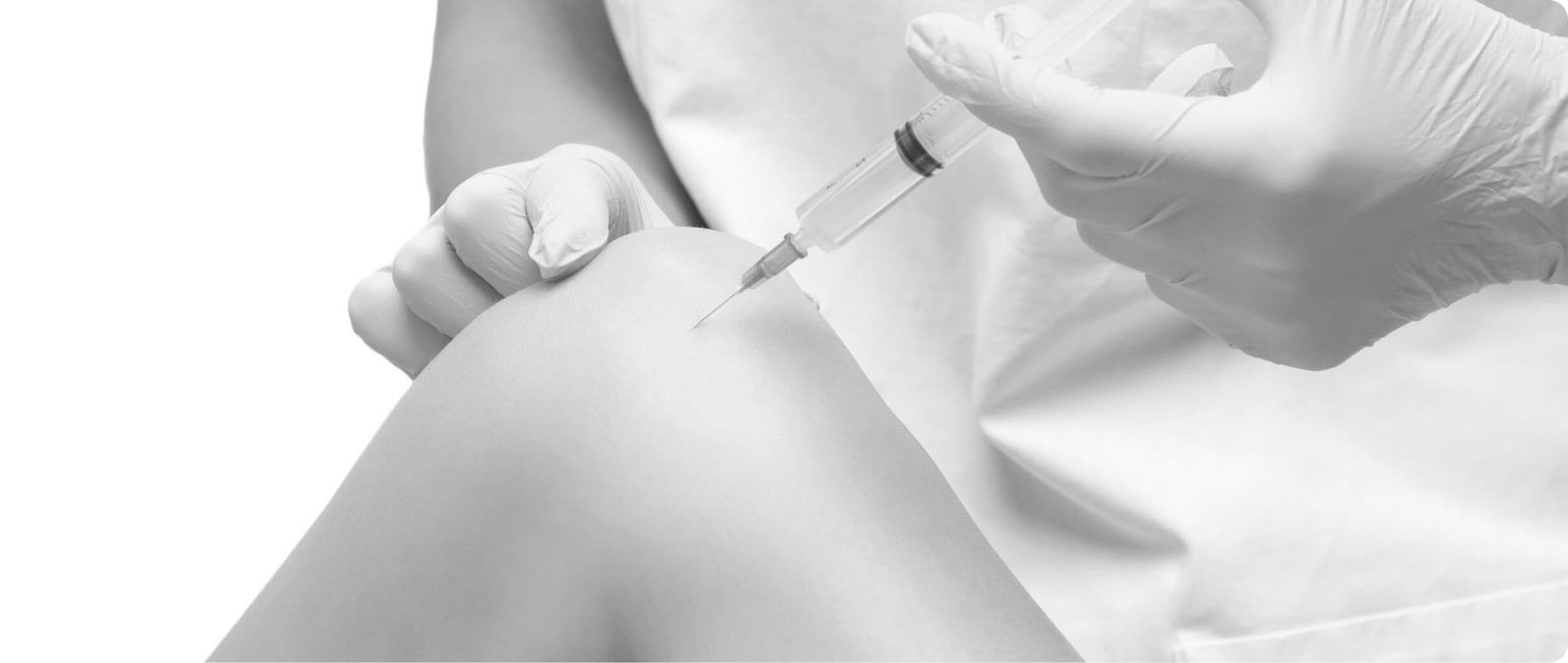 PRP hair restoration