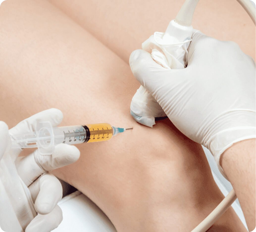 Why PRP hair restoration in Thailand