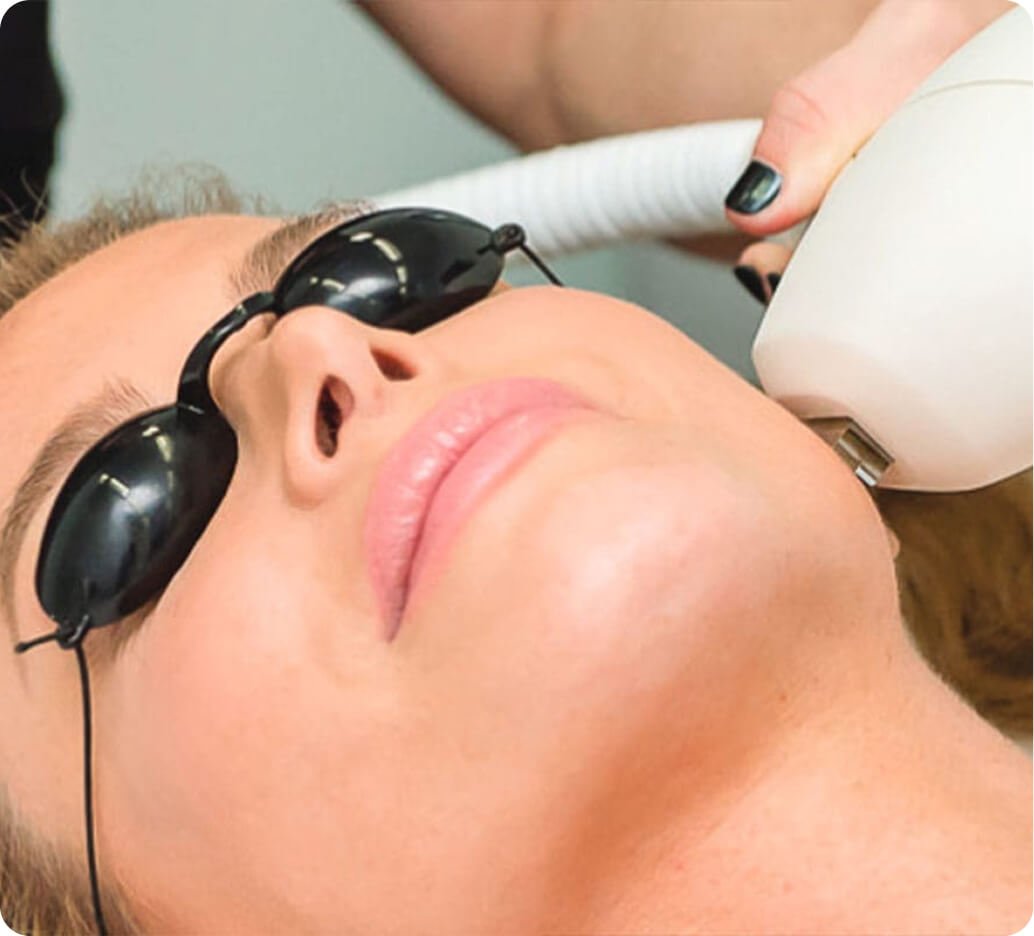Why photofacials in Thailand