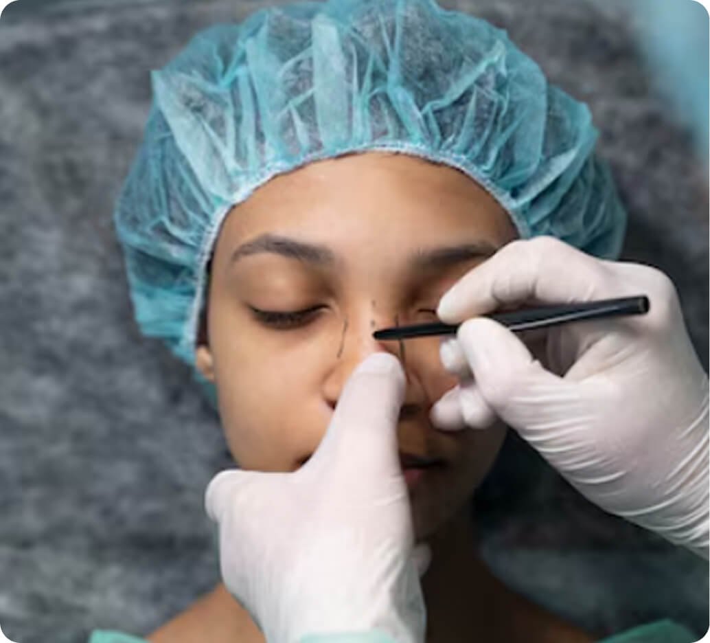 Why rhinoplasty in Thailand