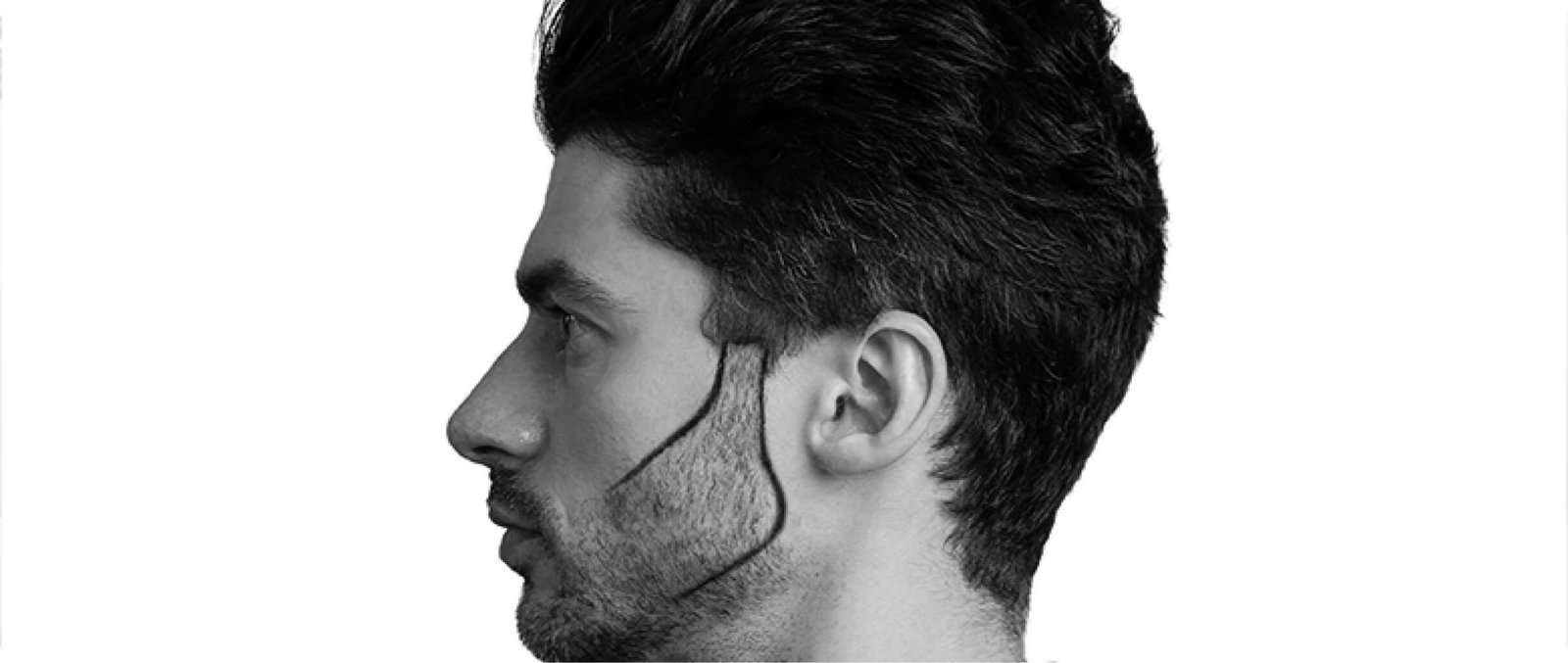 Sideburn restoration in Thailand