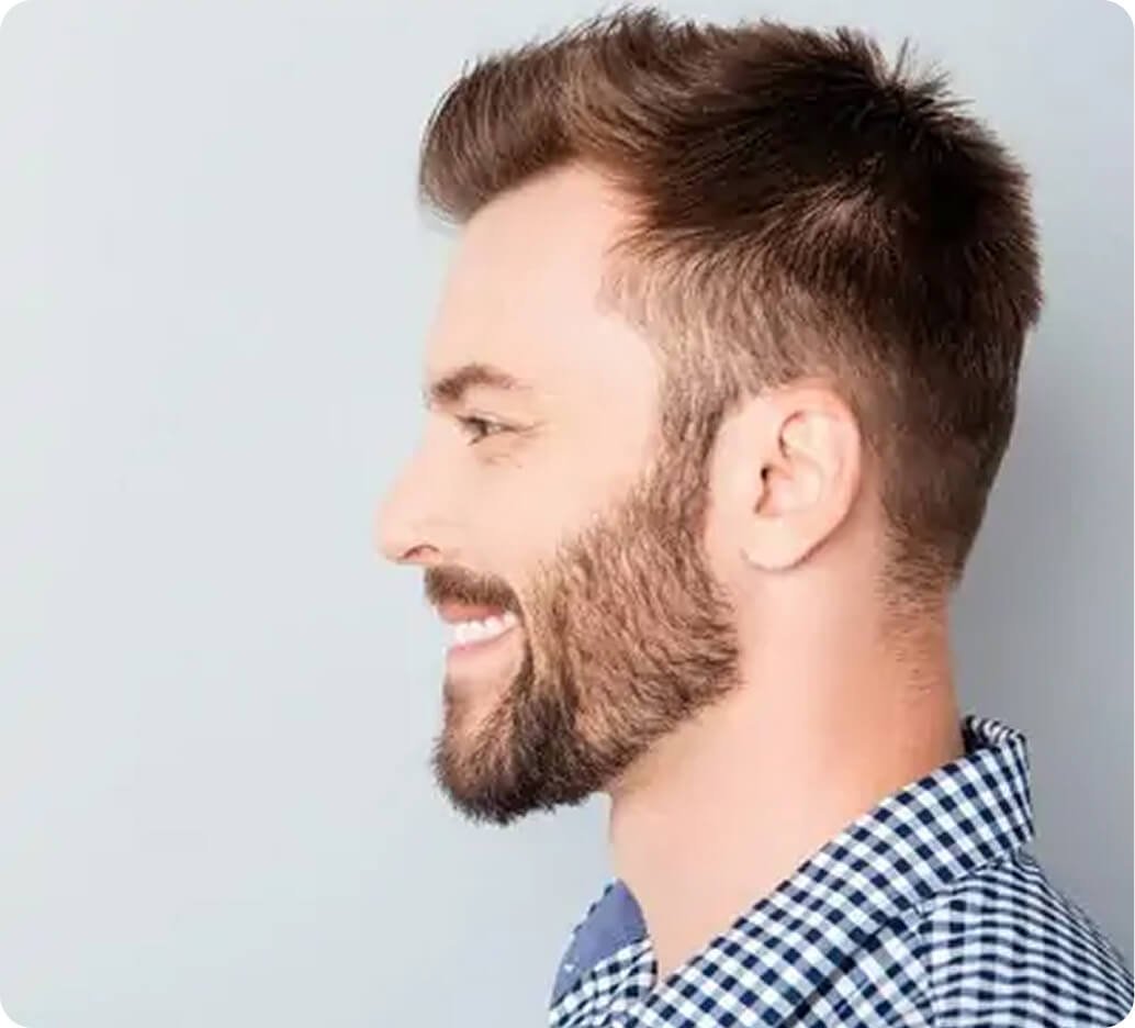 Why sideburn restoration in Thailand