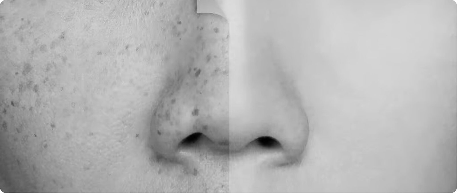 Skin rejuvenation treatments