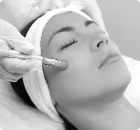 Microdermabrasion