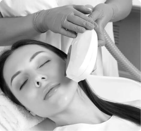 Photofacials IPL therapy