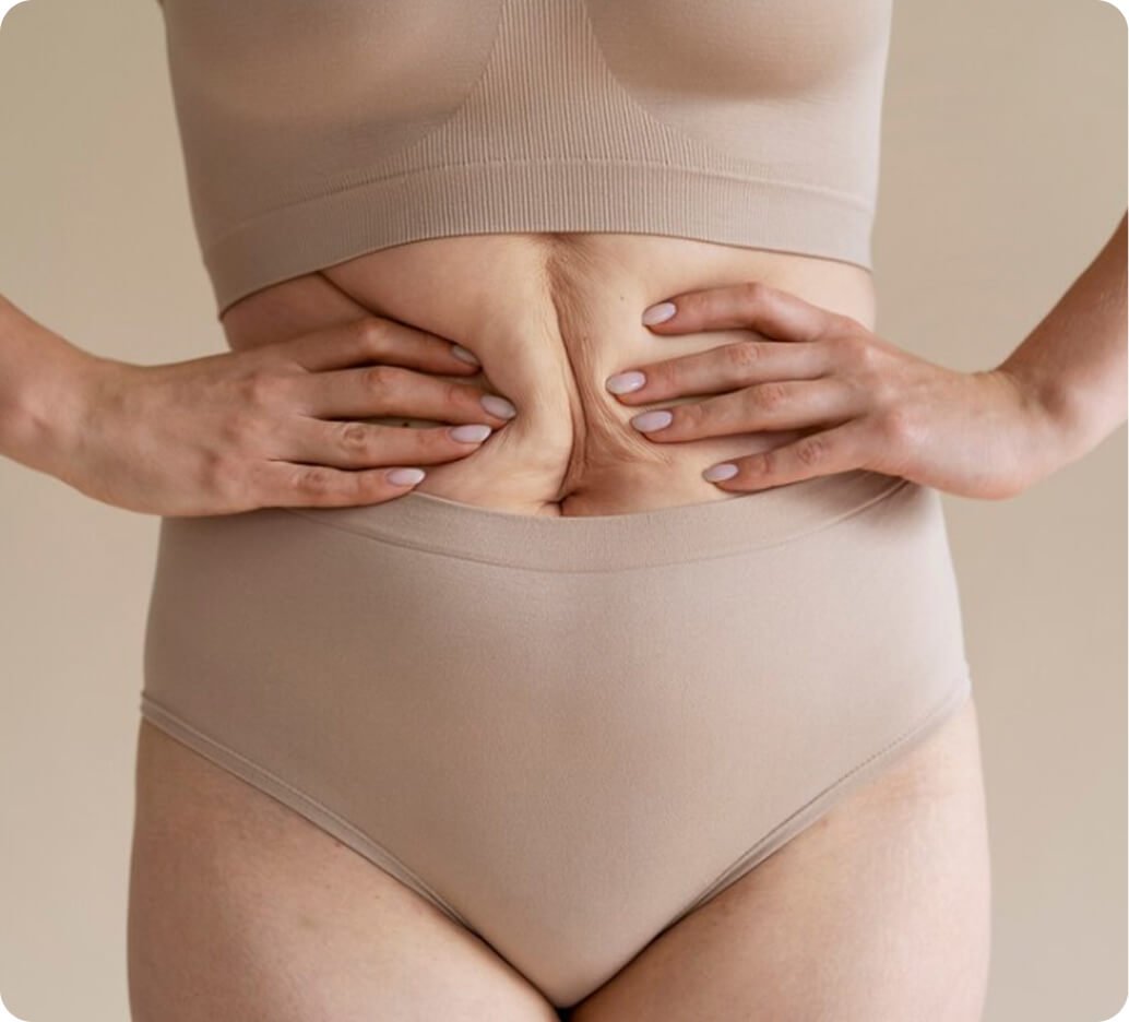 Why tummy tuck in Thailand